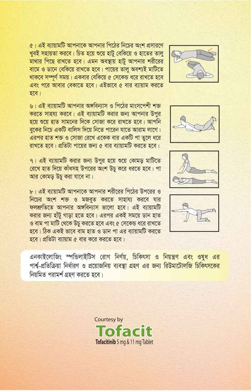 Ankylosing arthritis